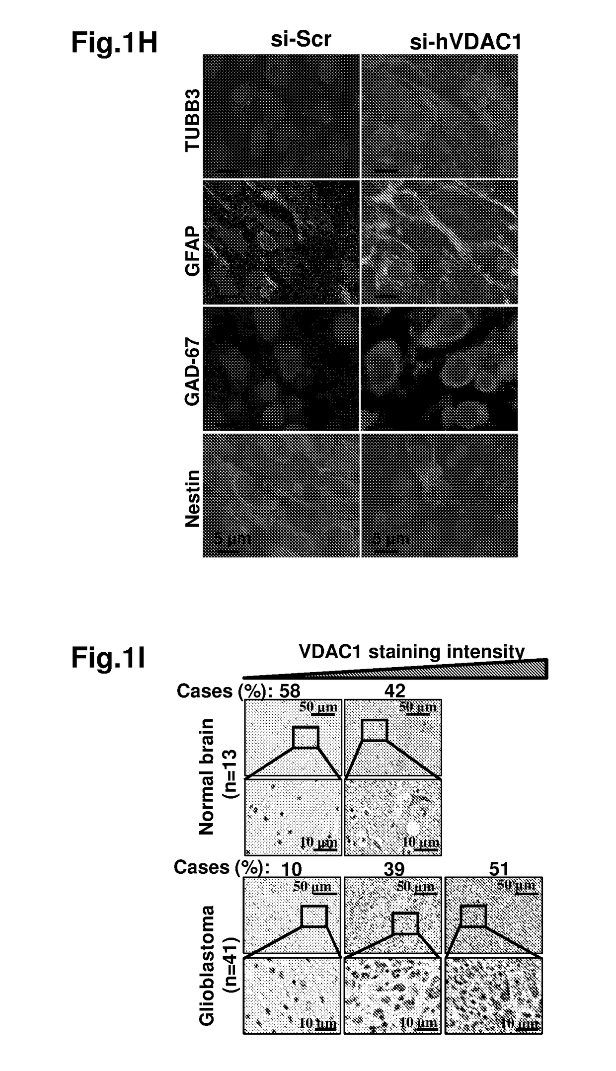 Means and methods for reducing tumorigenicity of cancer stem cells