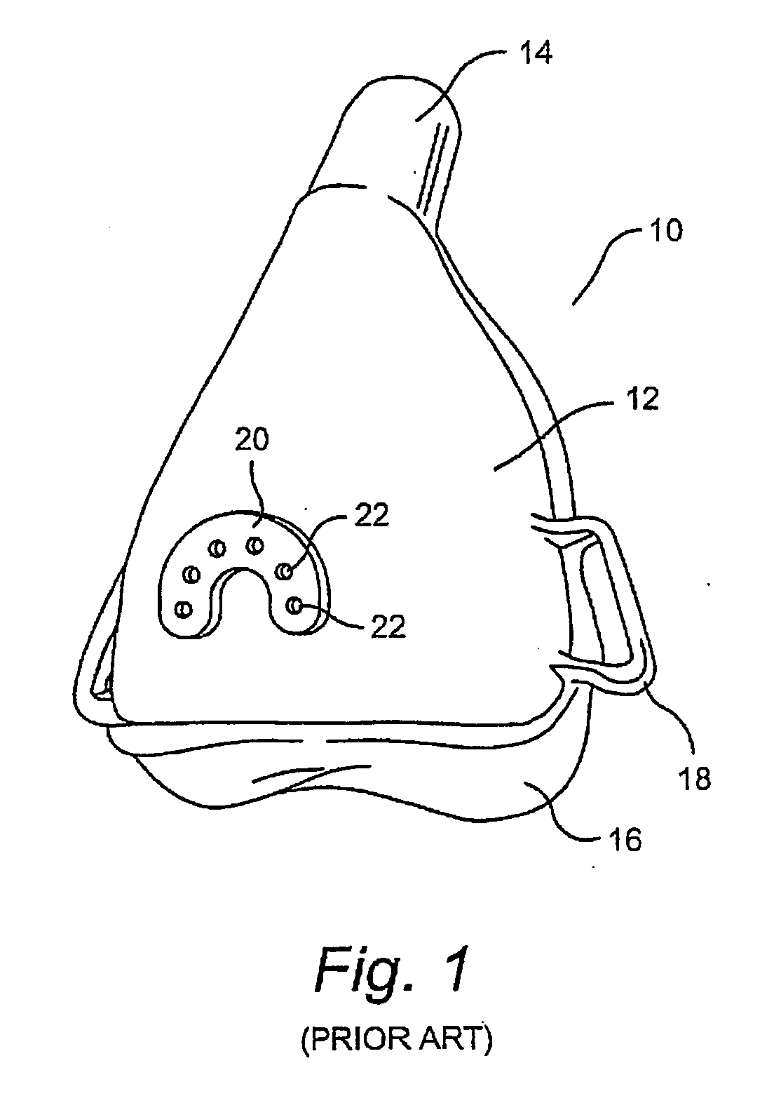 Injection control for non-invented mask