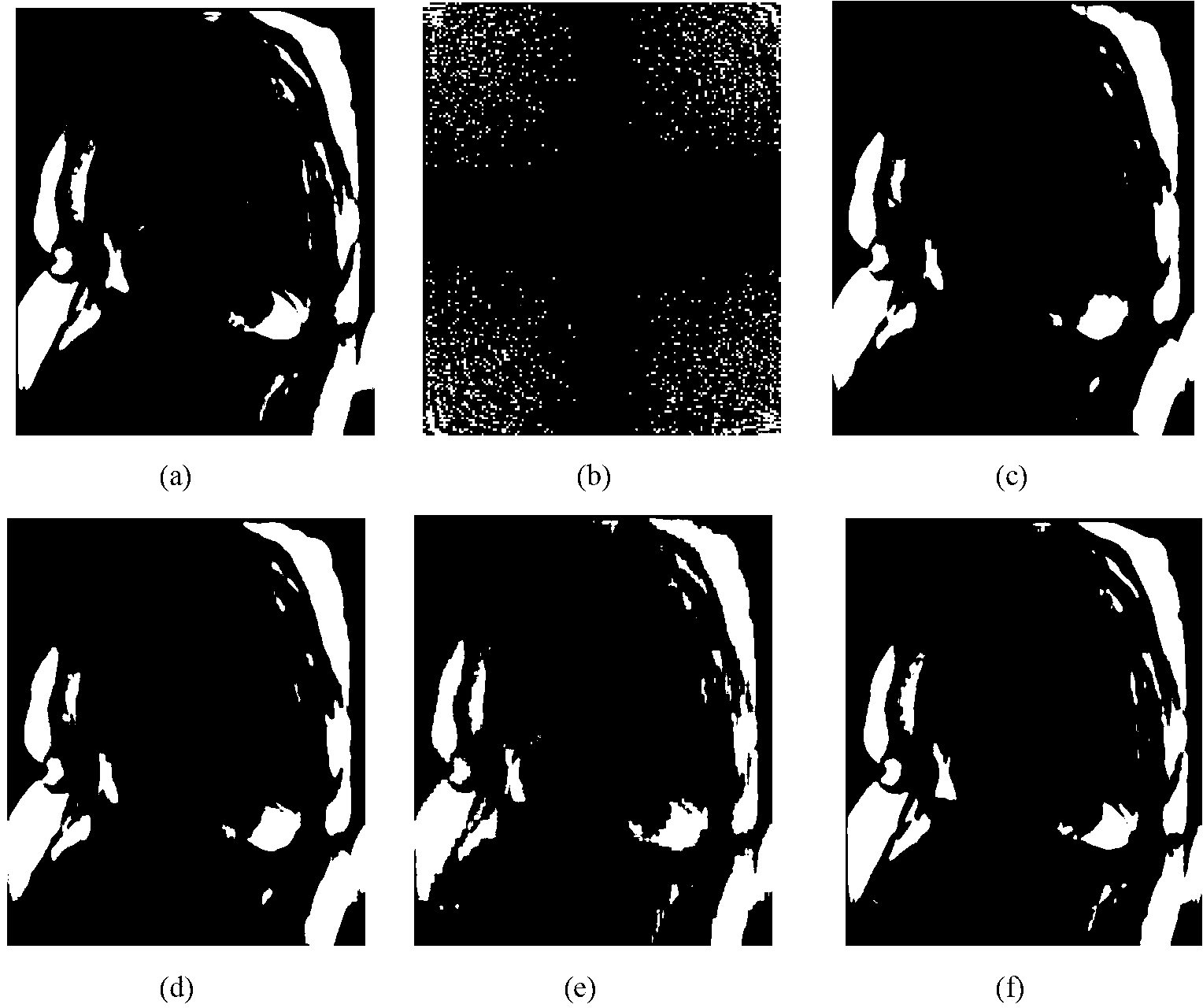 Partial K space sequence image reconstruction method based on self-adapted double-dictionary learning