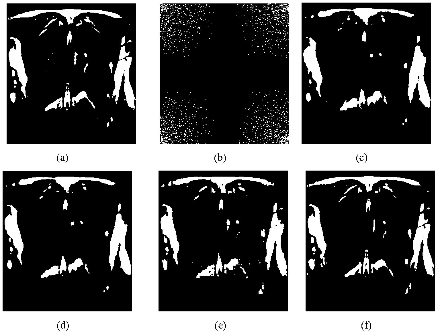 Partial K space sequence image reconstruction method based on self-adapted double-dictionary learning