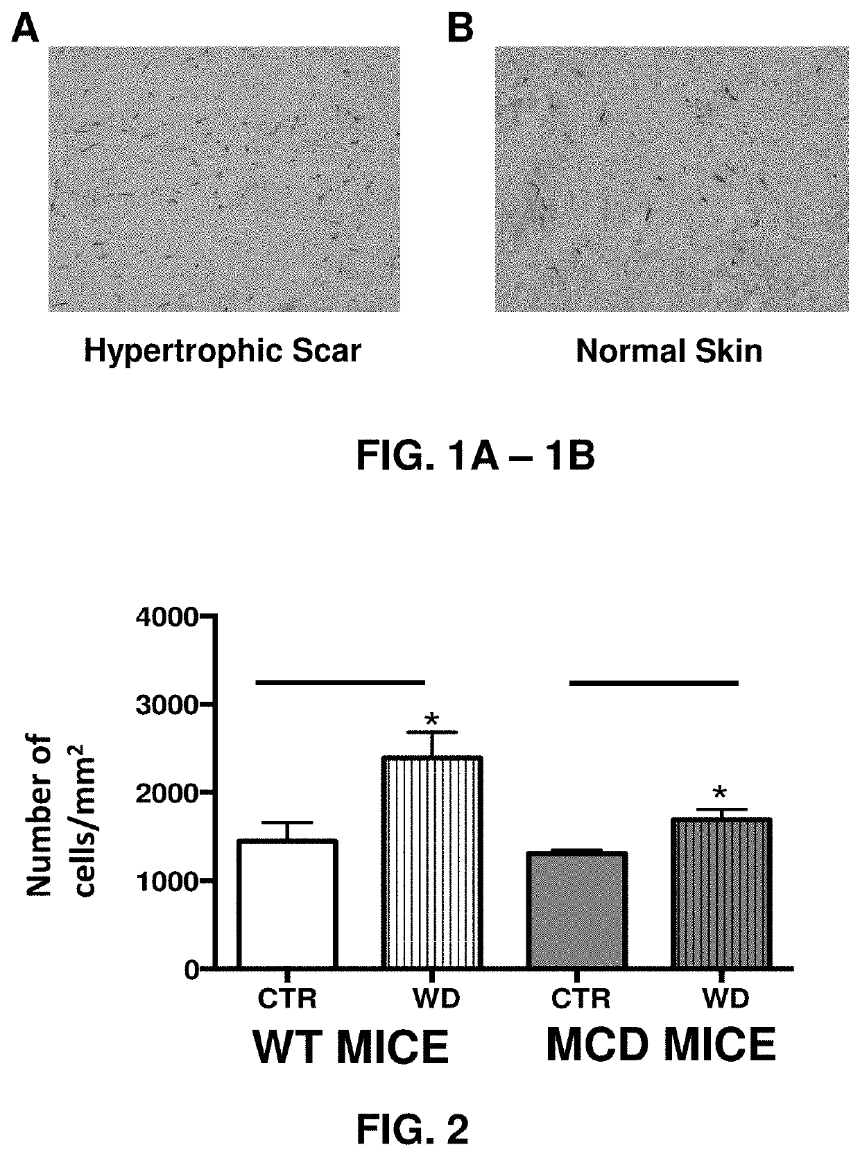 Methods for reducing abnormal scar formation