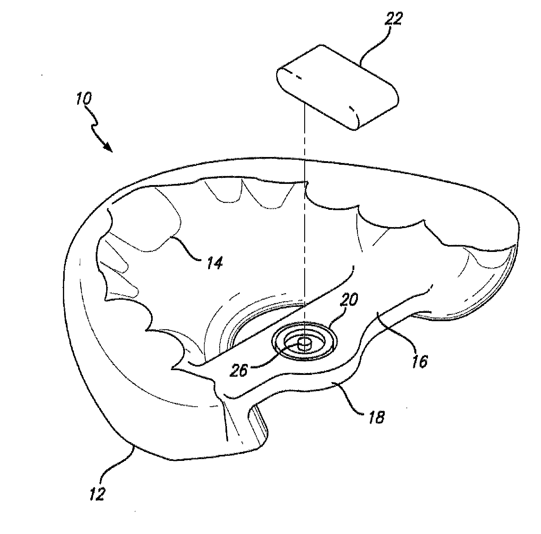 Dental sleep appliance