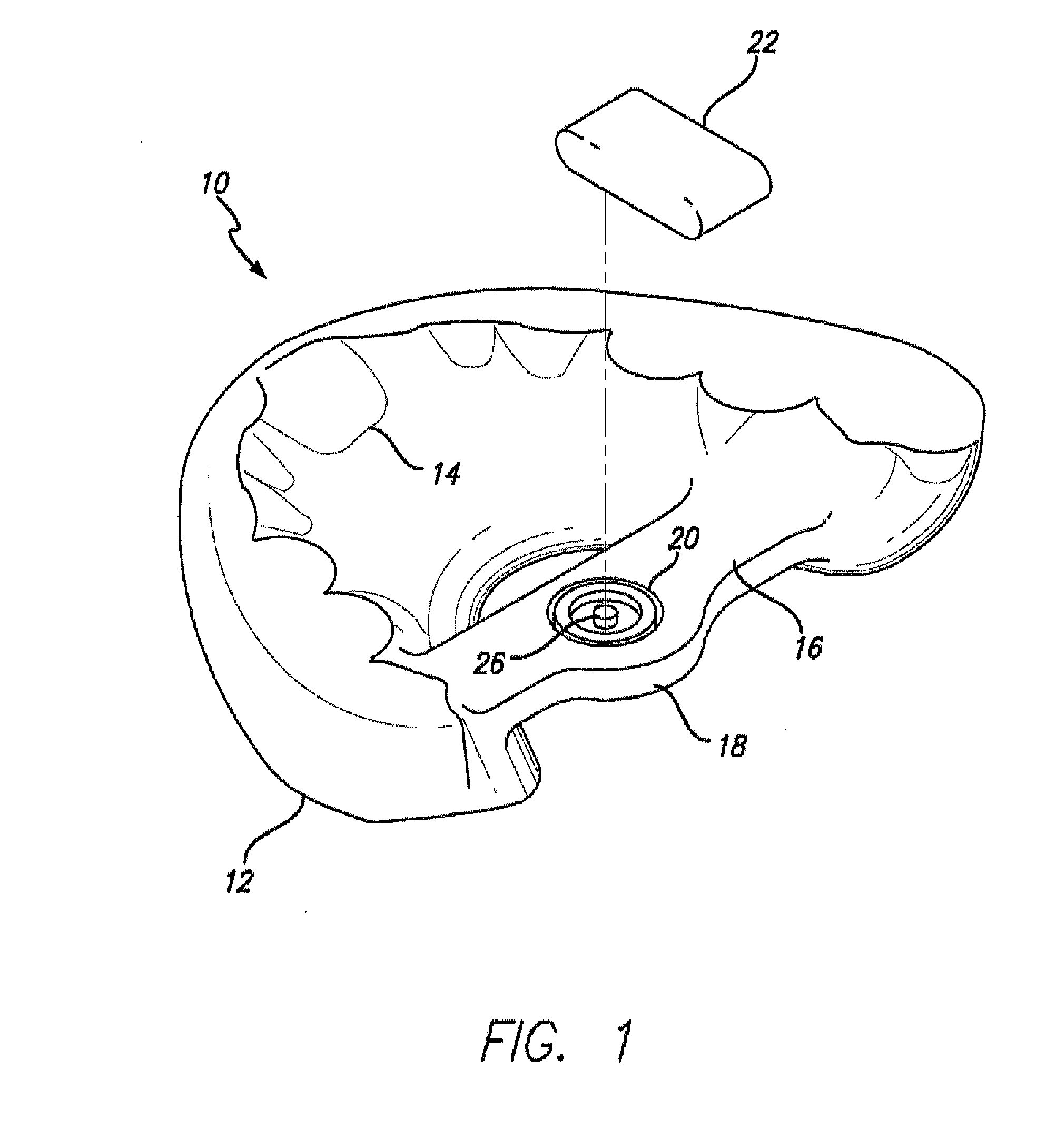 Dental sleep appliance