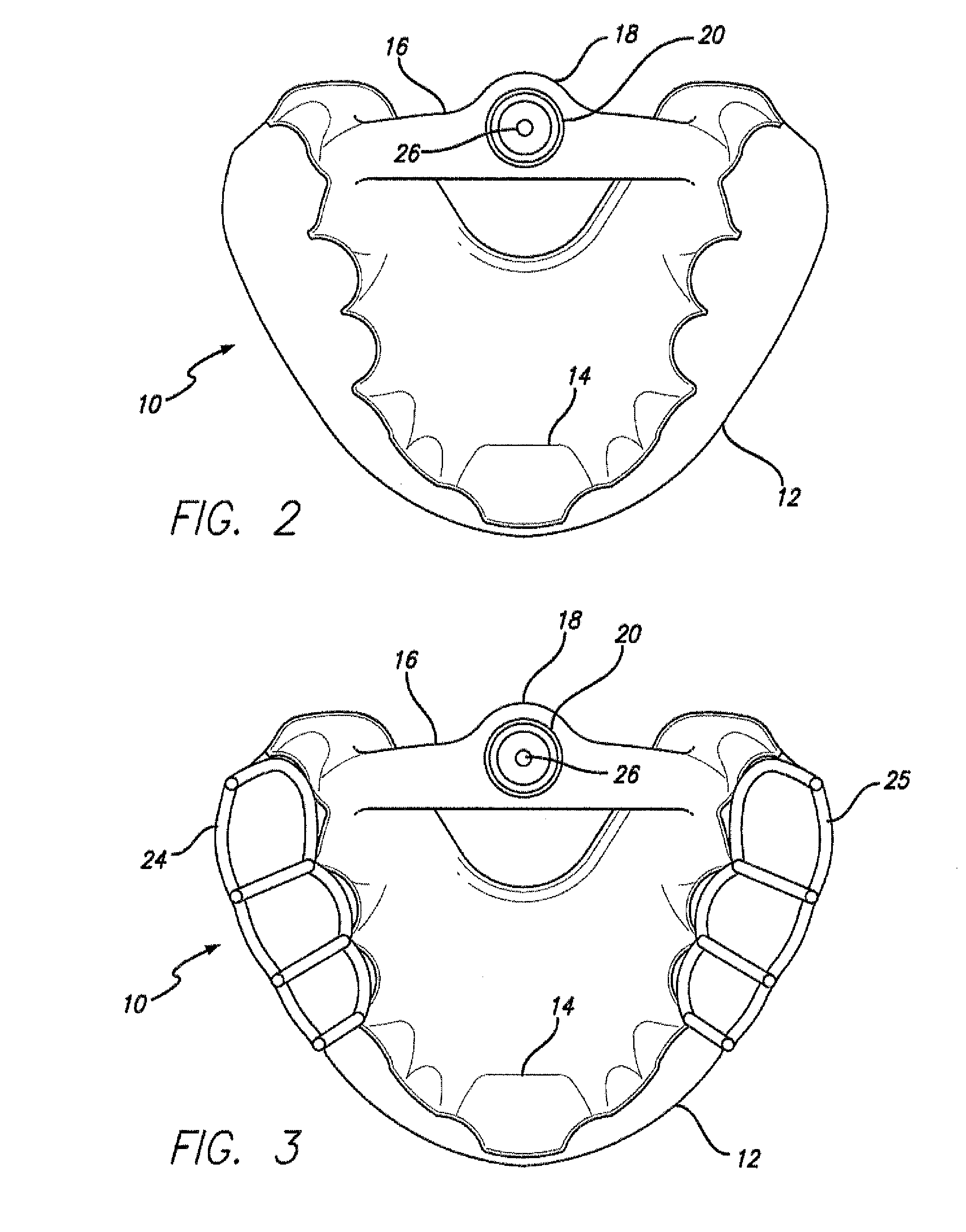 Dental sleep appliance