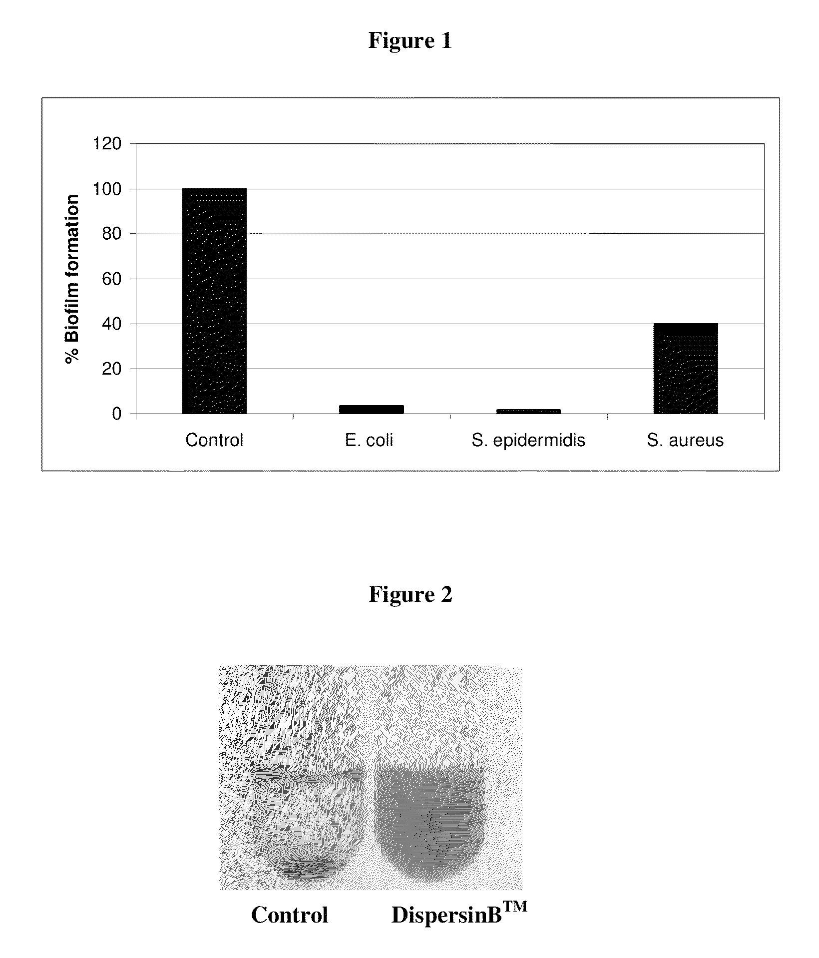 Soluble .beta.-N-acetylglucosaminidase based antibiofilm compositions and uses thereof