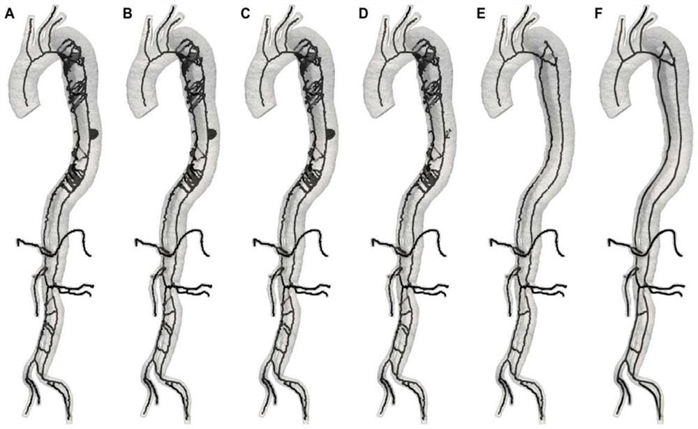 Skeleton line extraction method suitable for complex multi-cavity three-dimensional model