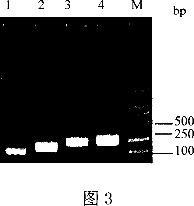 Recombined composite epitope antigen of liver cancer, preparation method, and application of preparing medication for specific immunity treatment of liver cancer