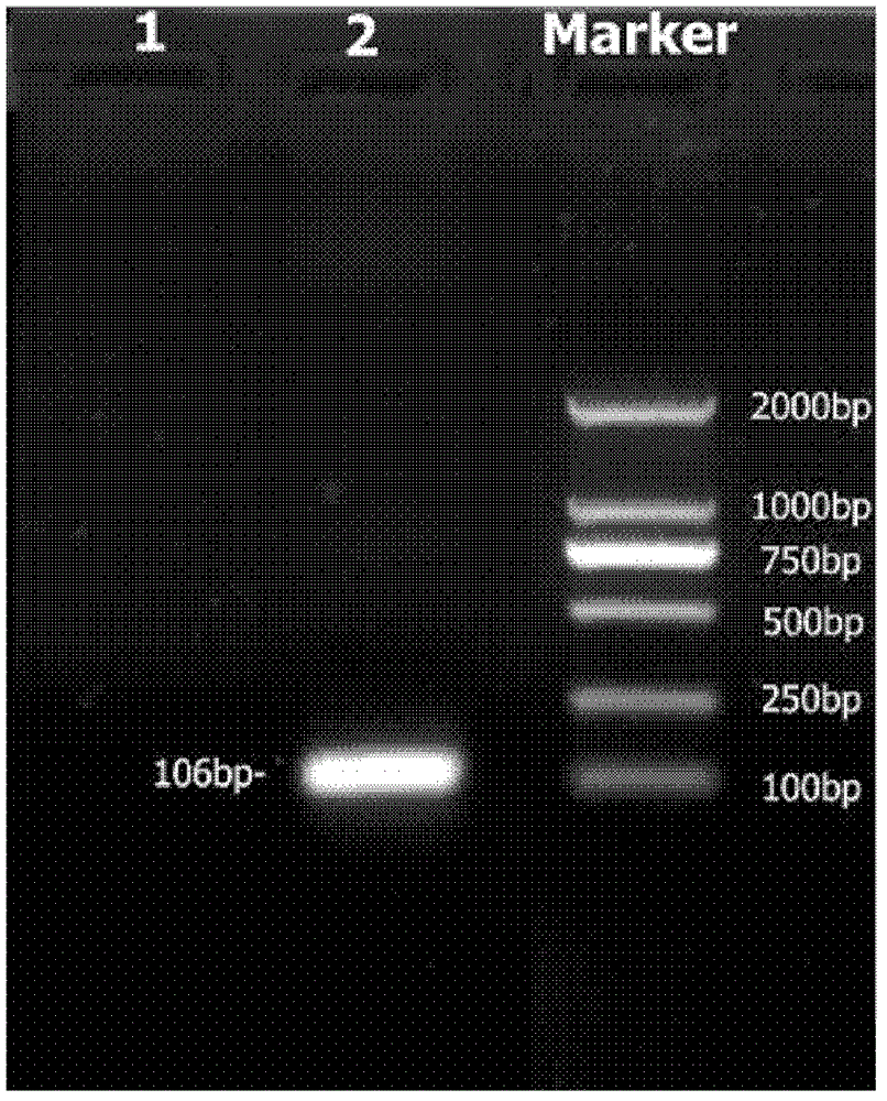 Fluorescence quantitative detection method of Ureaplasma urealyticum and Ureaplasma parvum