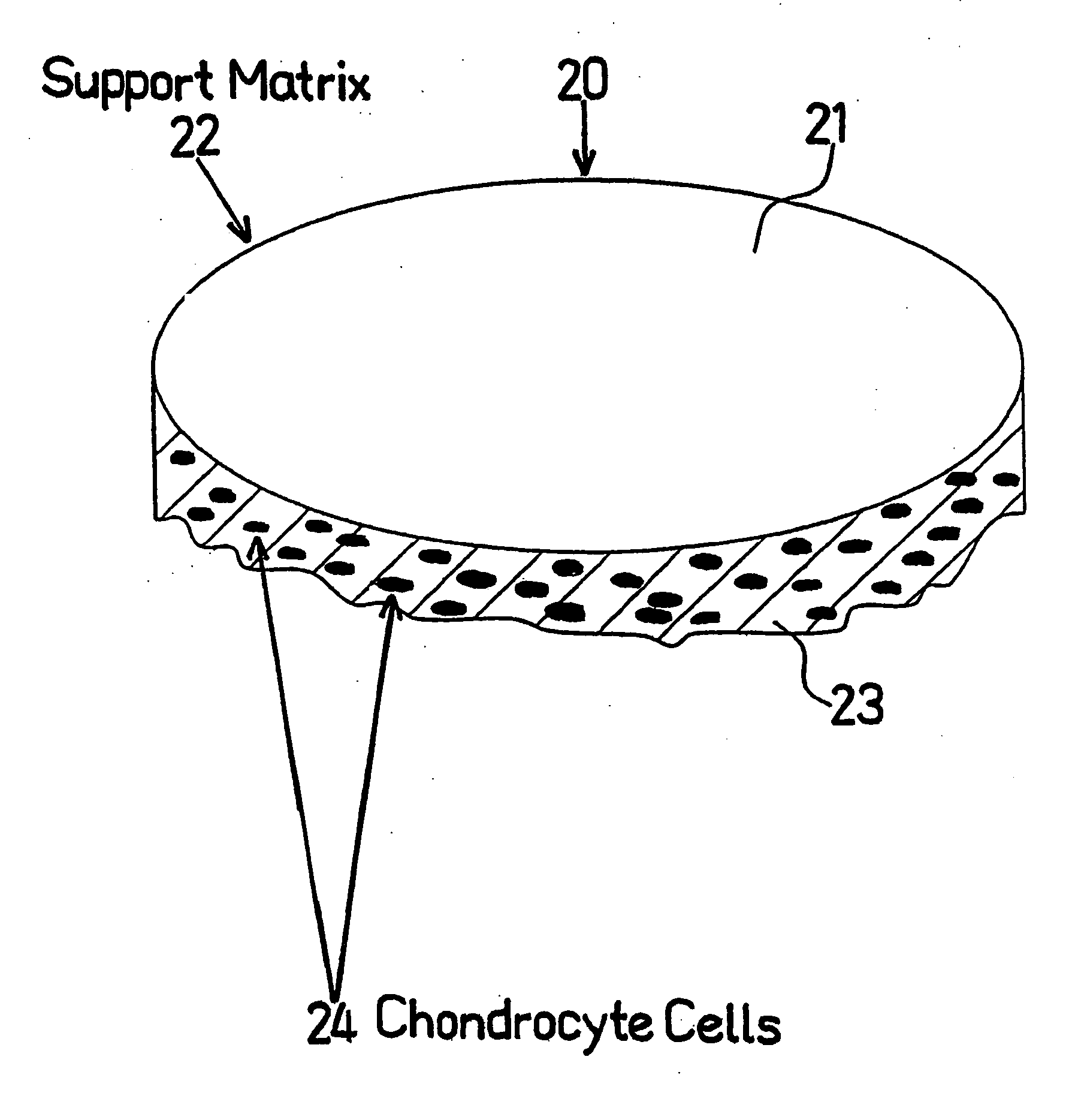 Method for autologous transplantation