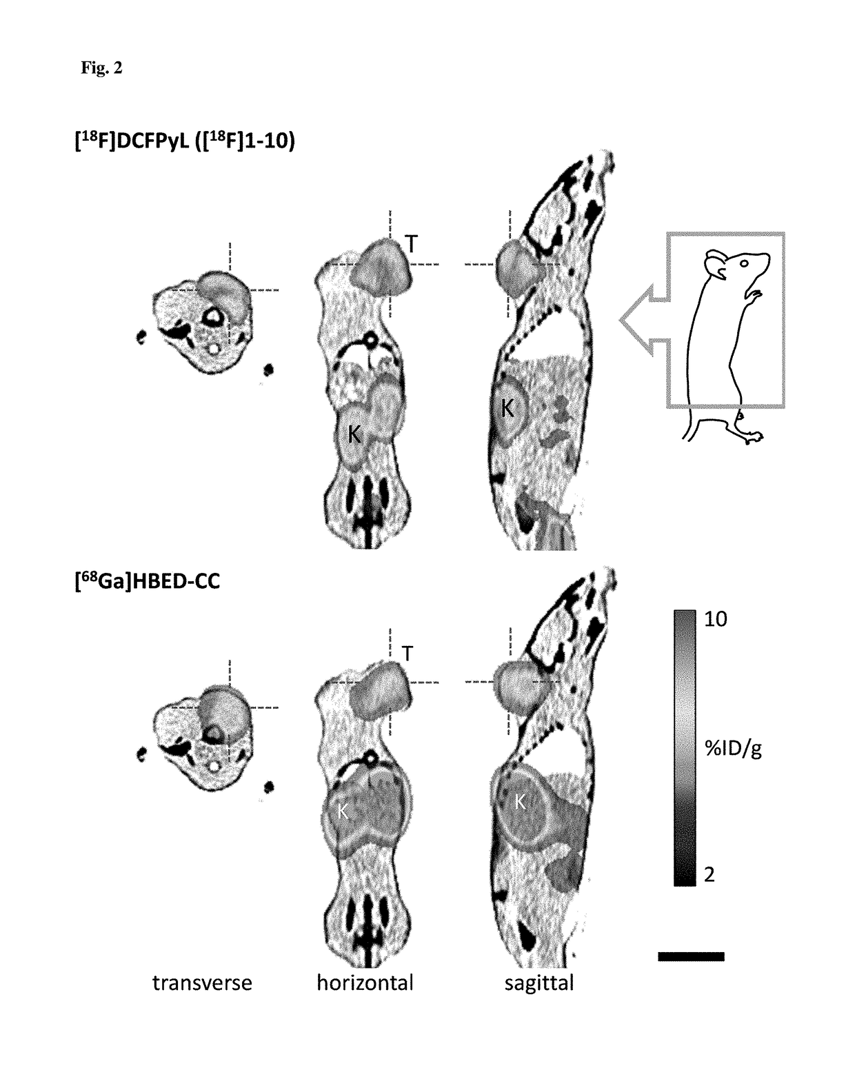 Method for the production of 18F-labeled active esters and their application exemplified by the preparation of a PSMA-specific PET-tracer
