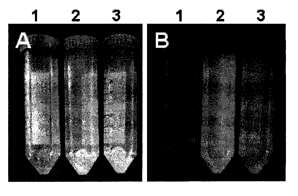 Application of cellulose binding domain in secretory expression system of corynebacteria