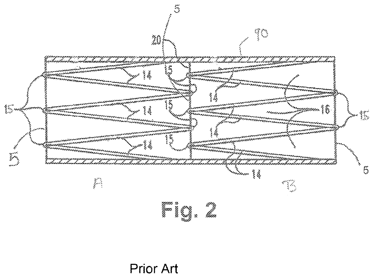 Modified Z Stents for Iliac Vein Stenting