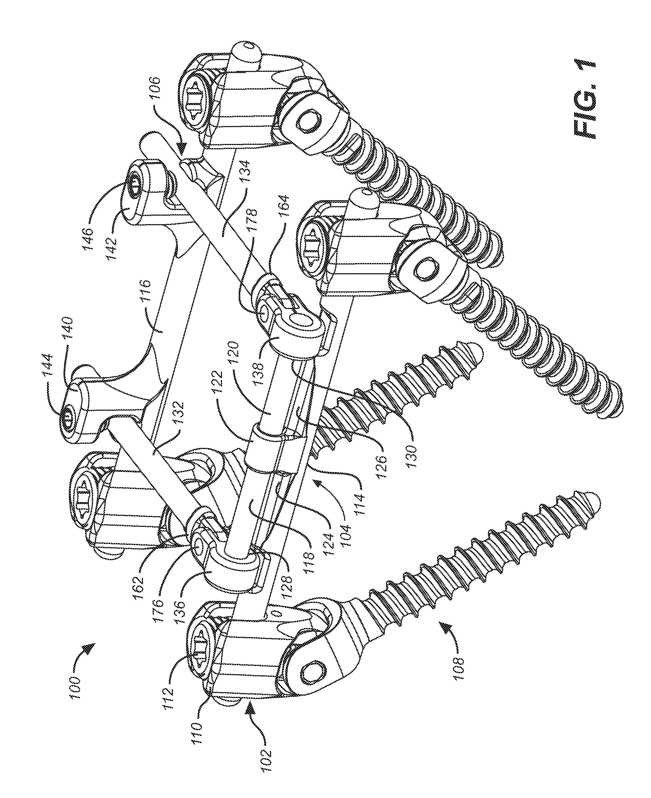 Reinforced bone anchor for a dynamic stabilization and motion preservation spinal implantation system and method