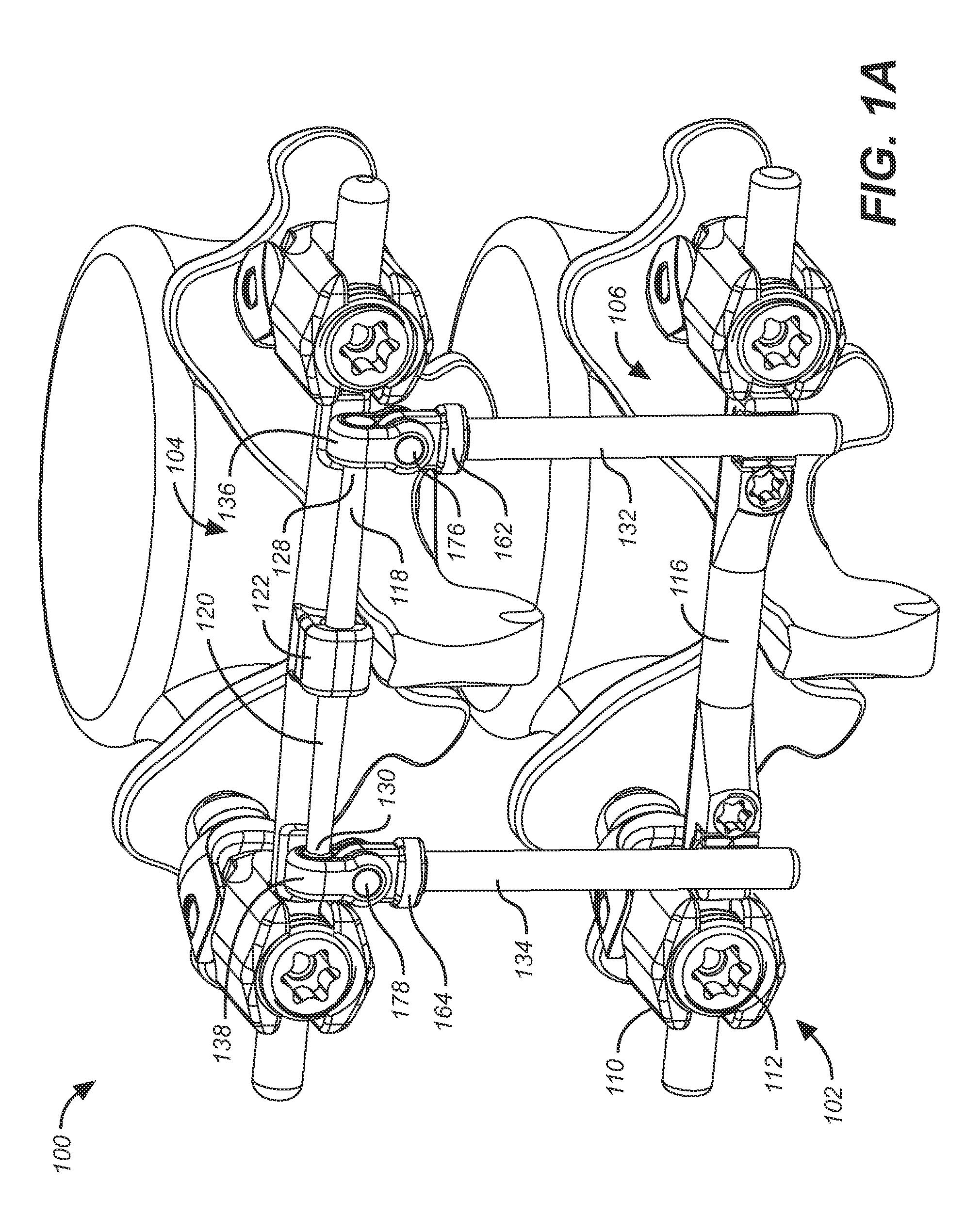 Reinforced bone anchor for a dynamic stabilization and motion preservation spinal implantation system and method