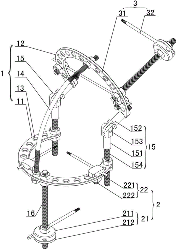 Shoulder joint dynamic and static combined regulation external fixator