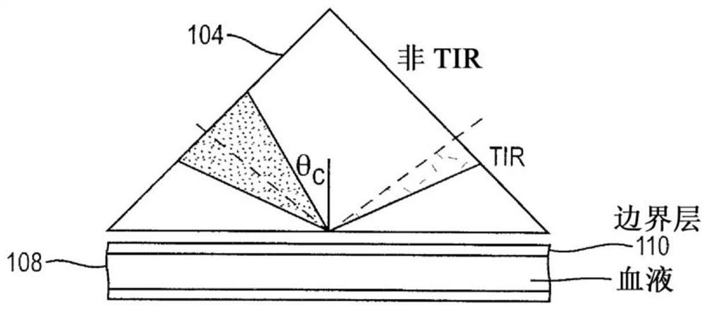 Total protein measurement using whole blood refractometry