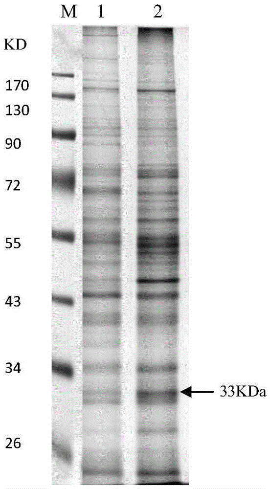 Novel application of inhibitor of hsd17b13 protein or its coding gene