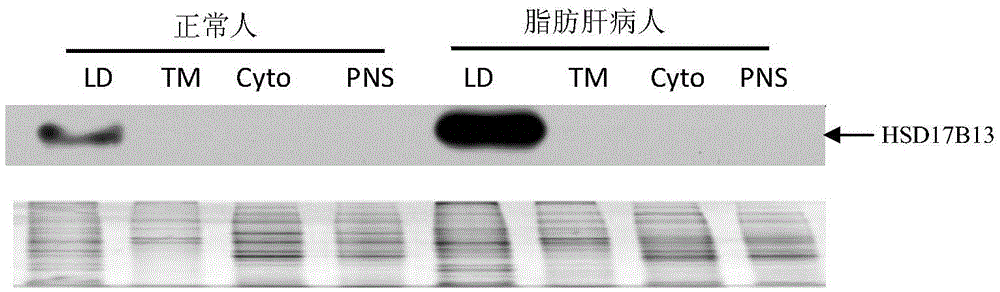 Novel application of inhibitor of hsd17b13 protein or its coding gene
