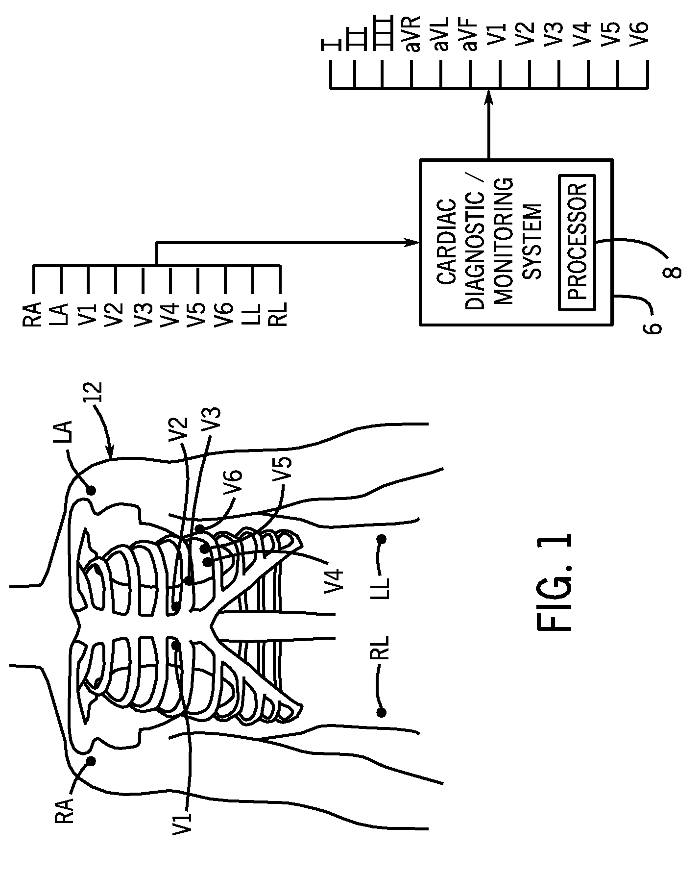 Method and system for detecting T-wave alternans