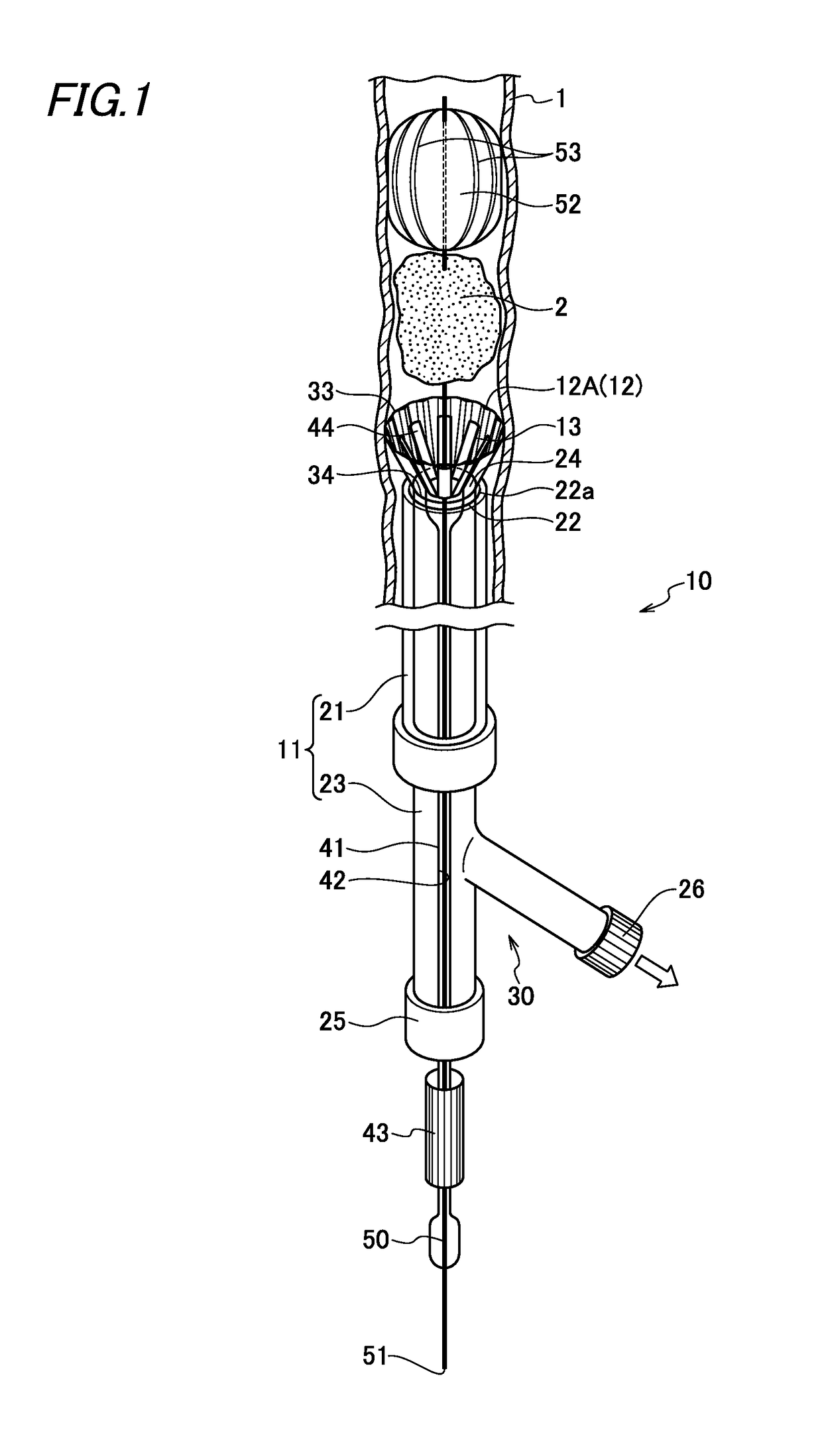 Catheter for removing foreign body in blood vessel