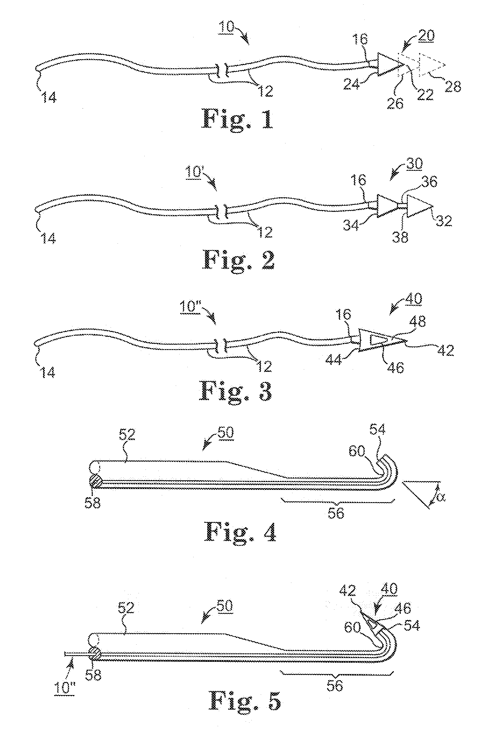 Minimally Invasive Methods and Apparatus for Accessing and Ligating Uterine Arteries with Sutures