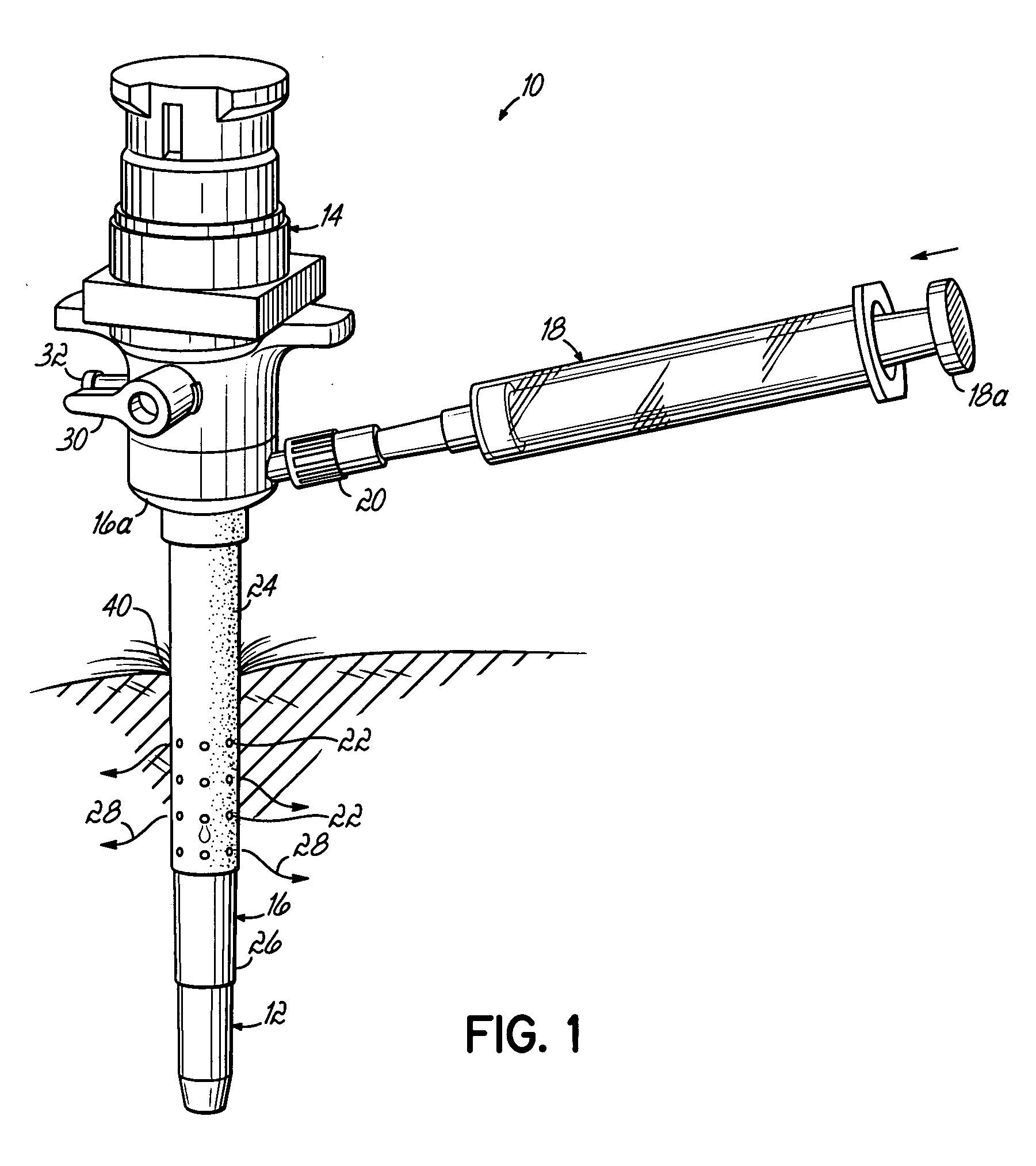 Trocar-cannula complex, cannula and method for delivering fluids during minimally invasive surgery