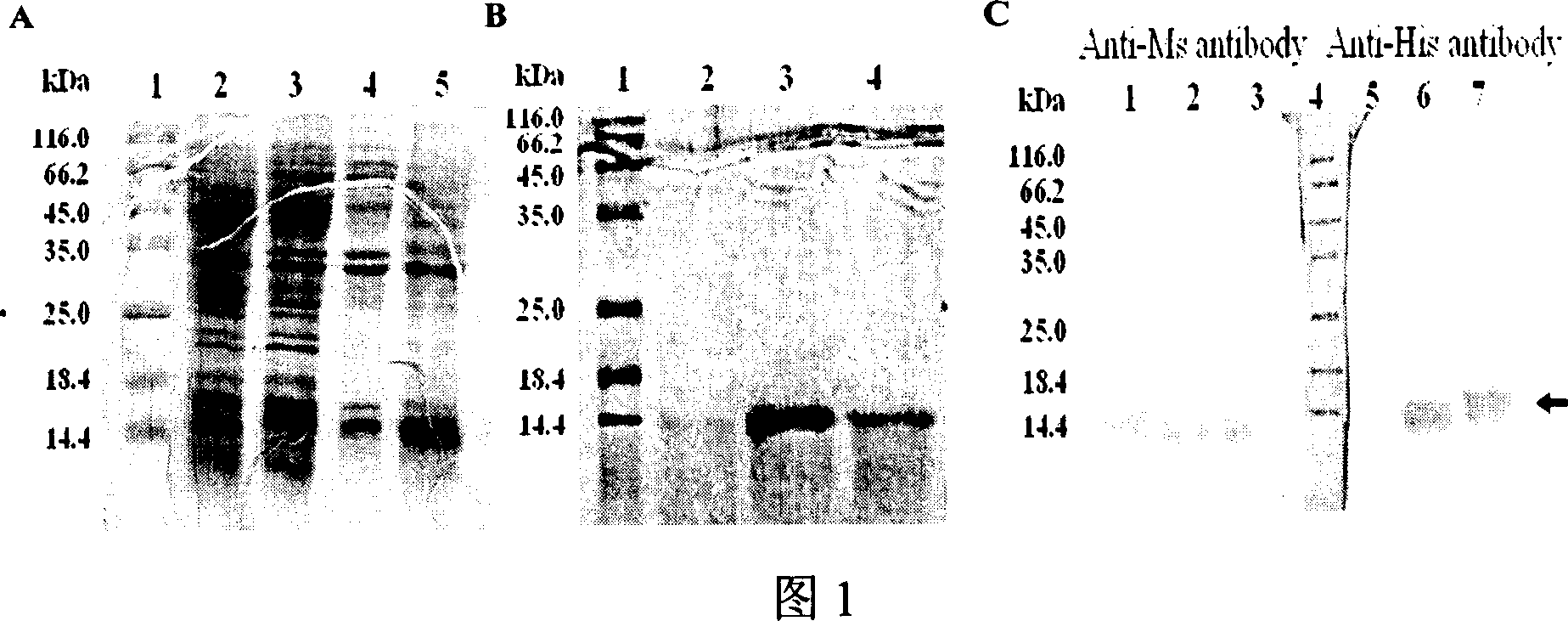 Therapeutic vaccine for Myostatin specific antibody and its preparation method