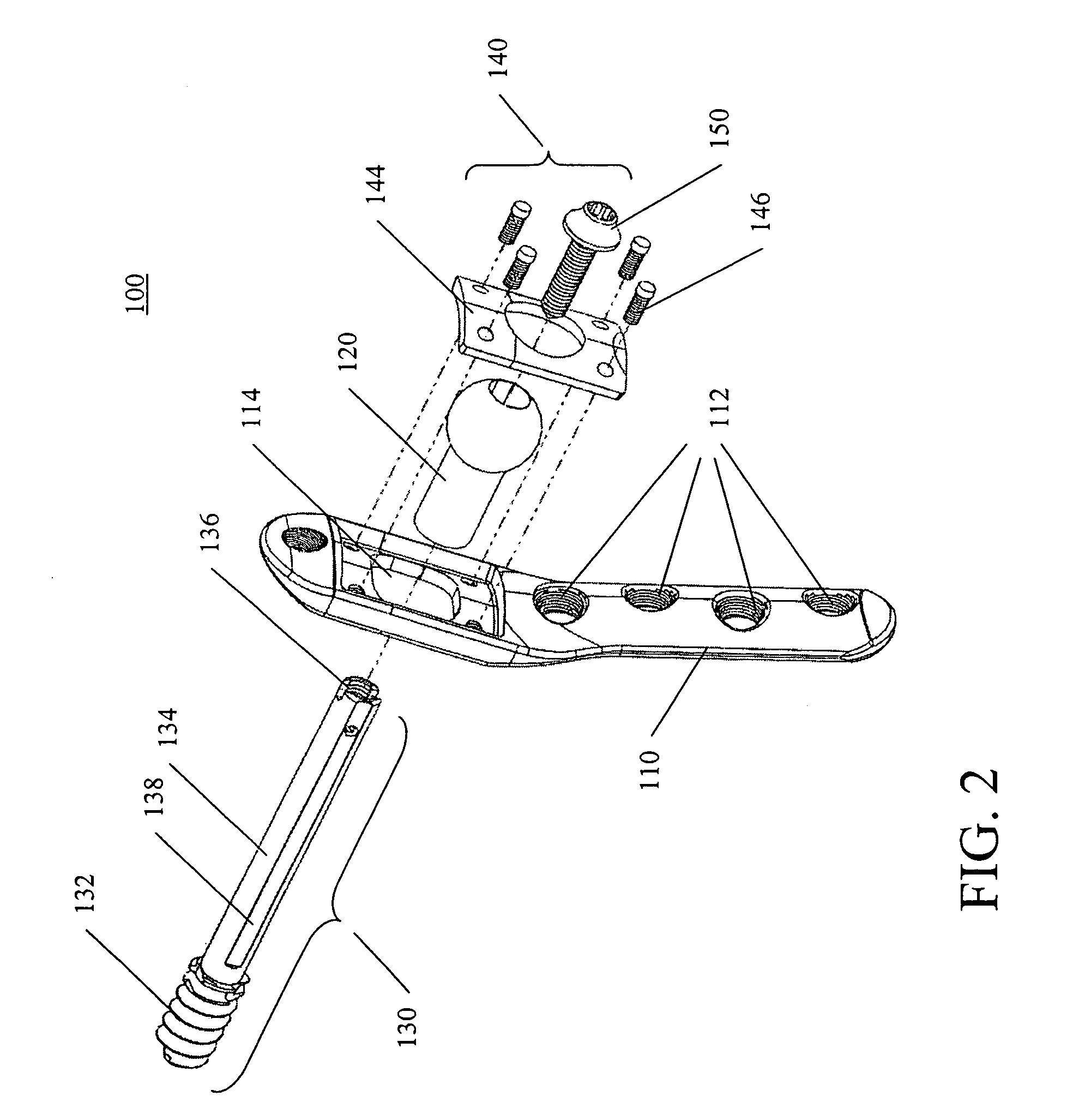 Methods for treating fractures of the femur and femoral fracture devices