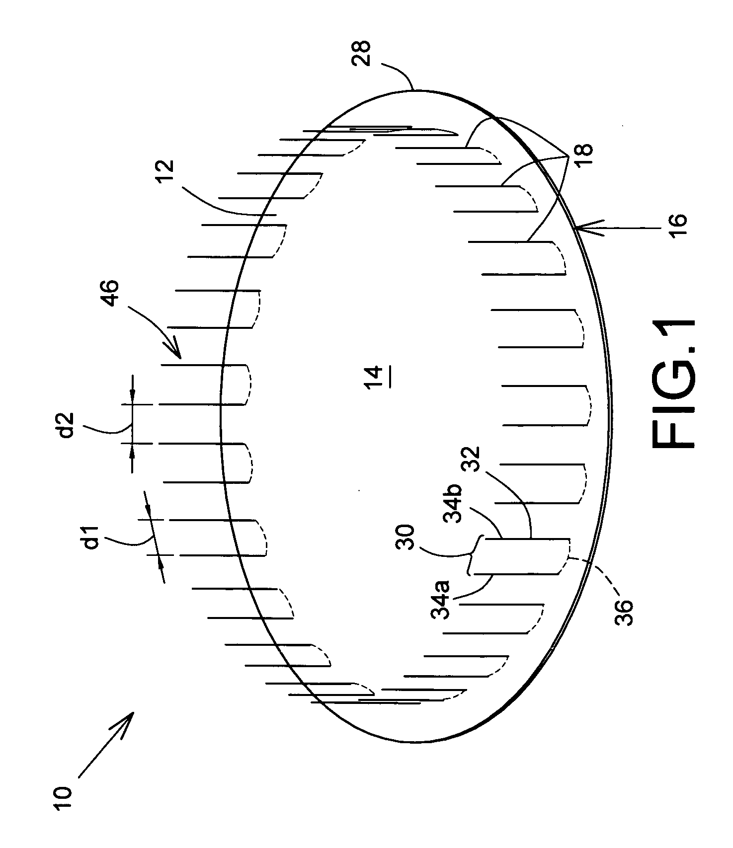 Prosthetic repair patch with integrated sutures and method therefor