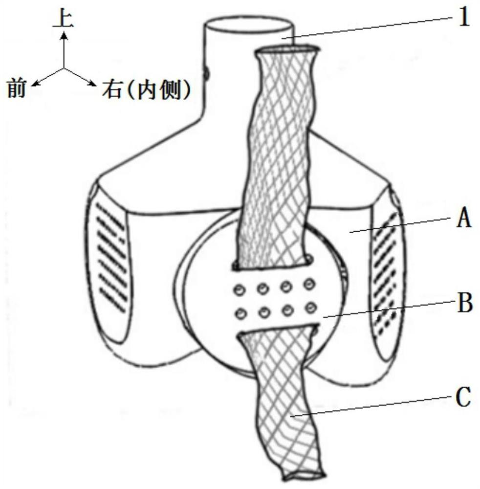 An energy-saving bionic tension-compression body patellofemoral joint for bipedal walking robot