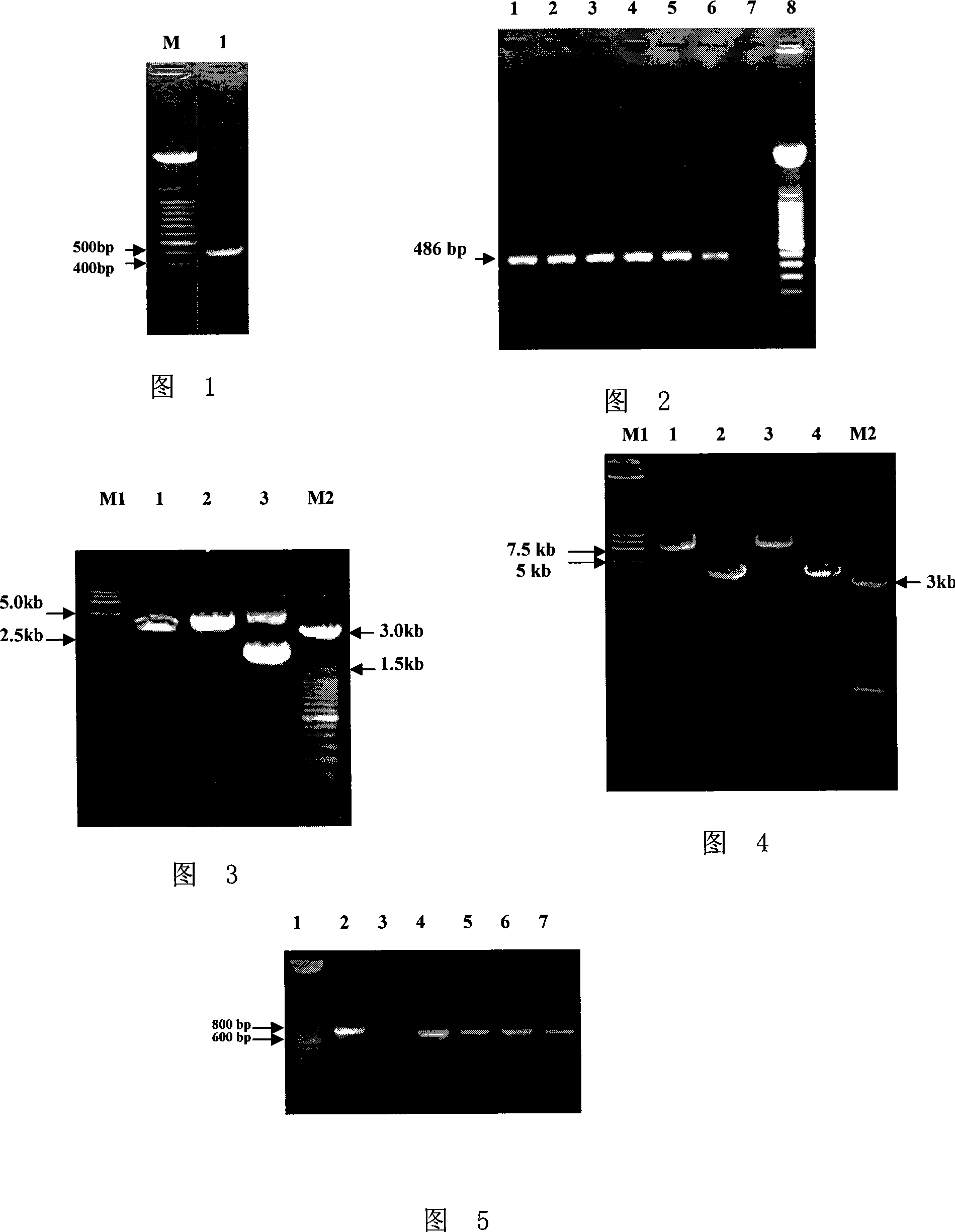 Method for constructing PRRSV gene deletion vaccine toxin strain by using Nsp2 gene deletion and uses thereof