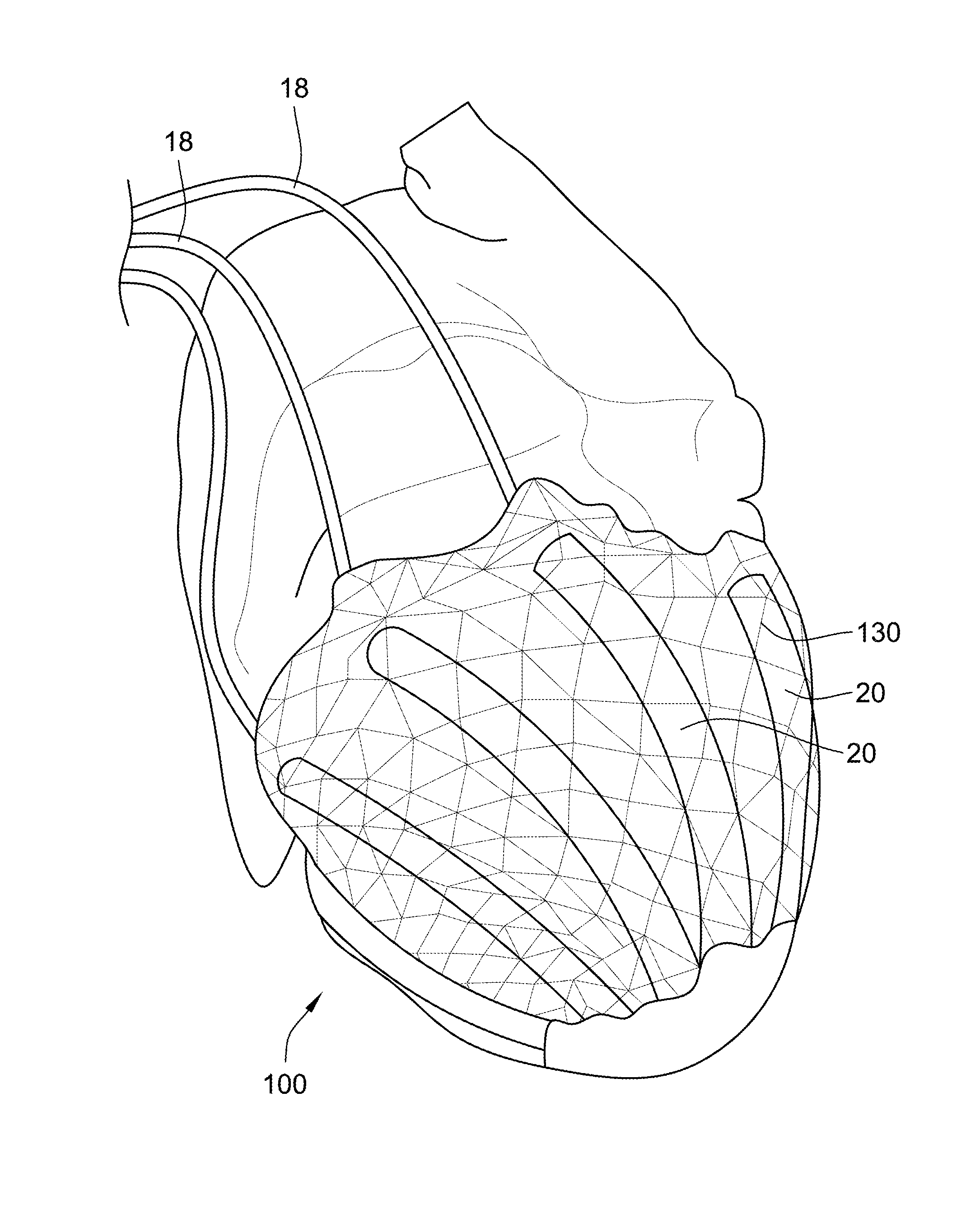 Biomimetic actuation device and system, and methods for controlling a biomimetic actuation device and system