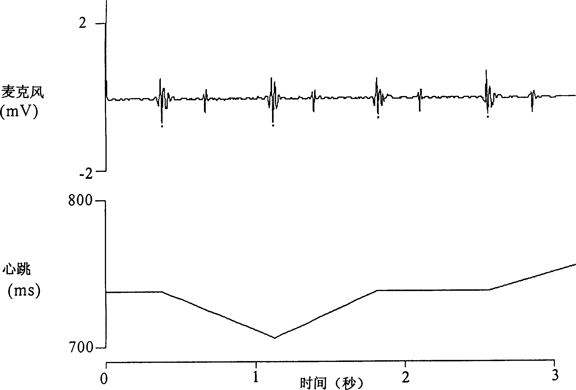 Vegetative nerve diagnosis system based on heart sound