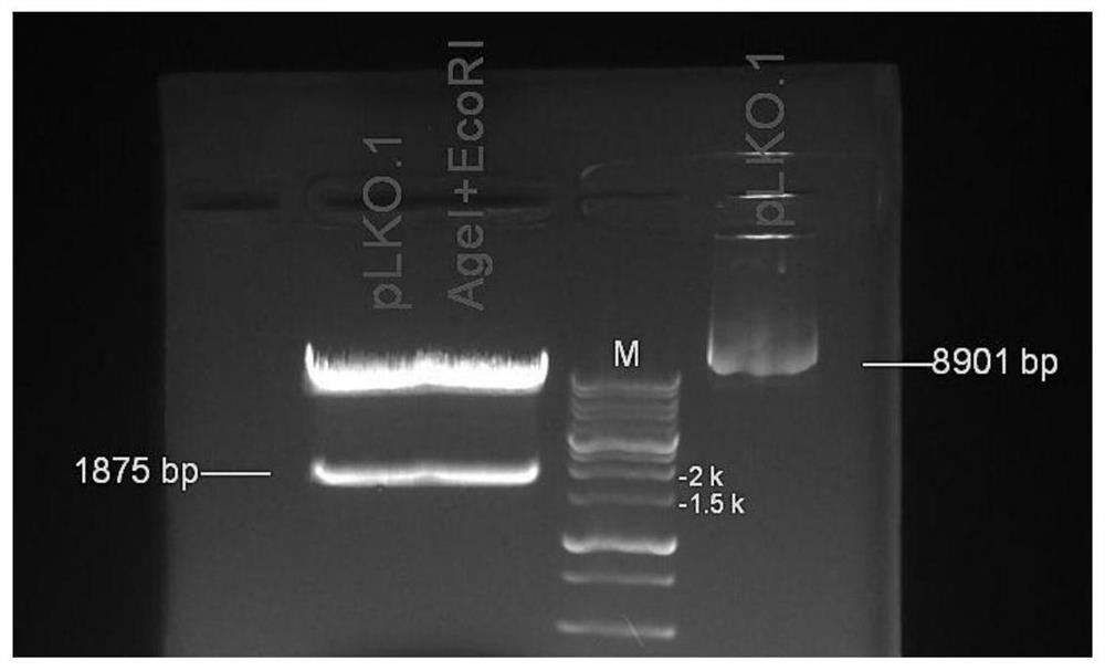 A kind of shRNA that inhibits the expression of hsa_circ_0001610 and its expression vector