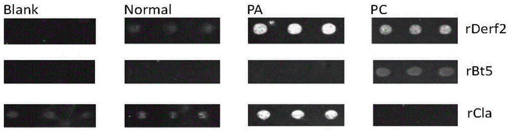 Serum allergen specific IgE detection method based on micro-fluidic chip and protein chip