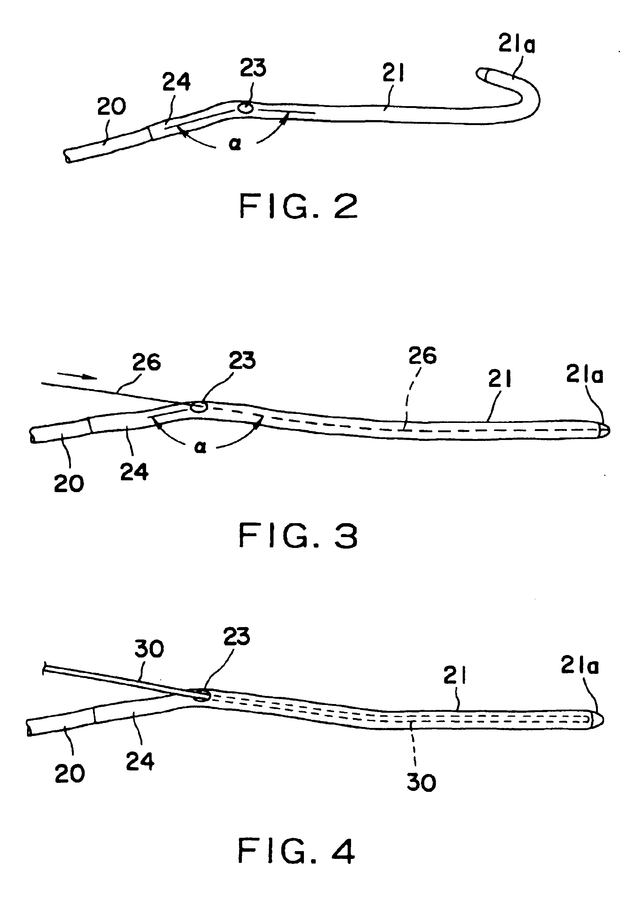 Nasolacrimal duct tube used for lacrimal duct reformation operation, and nasolacrimal duct tube instrument