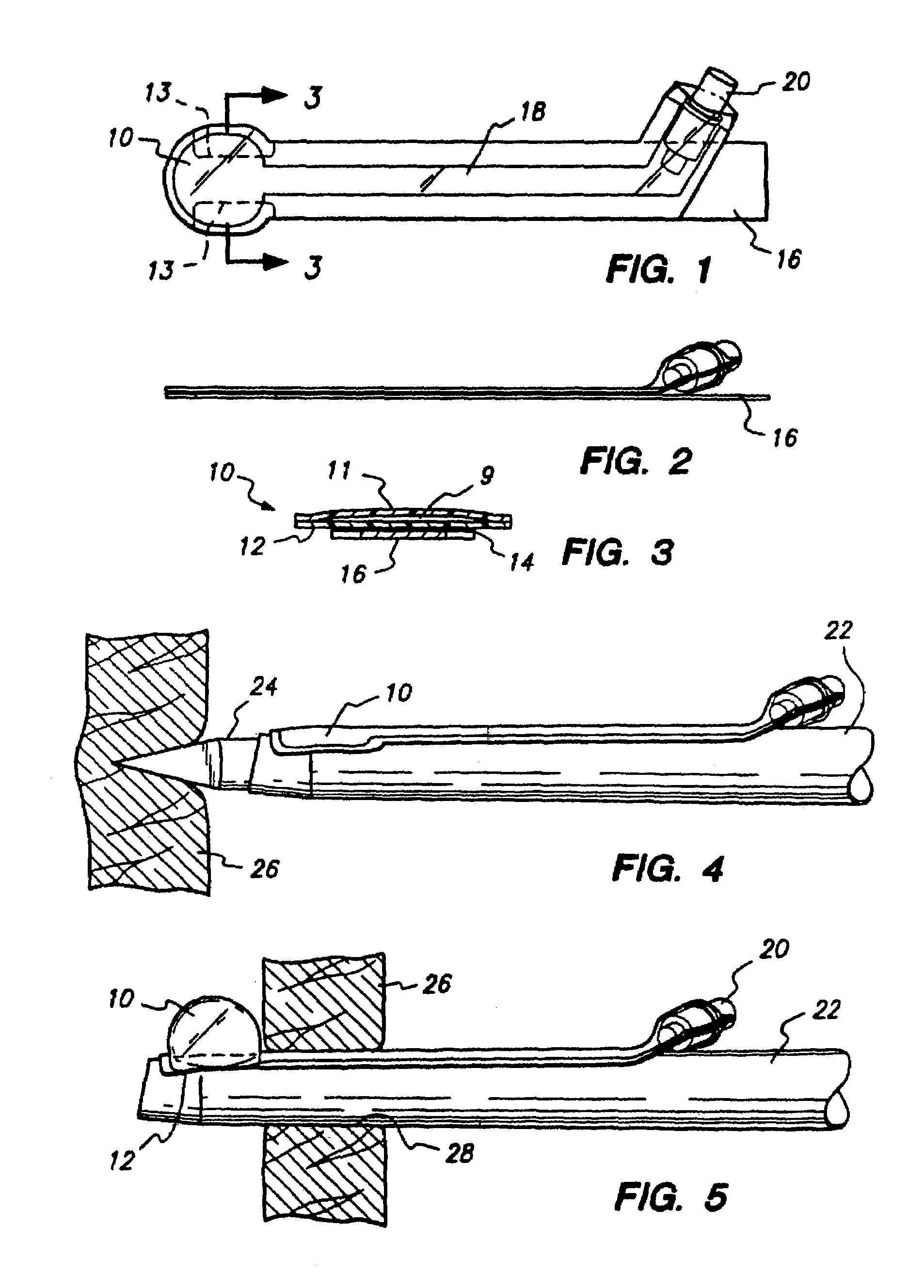 Method and apparatus for anchoring laparoscopic instruments