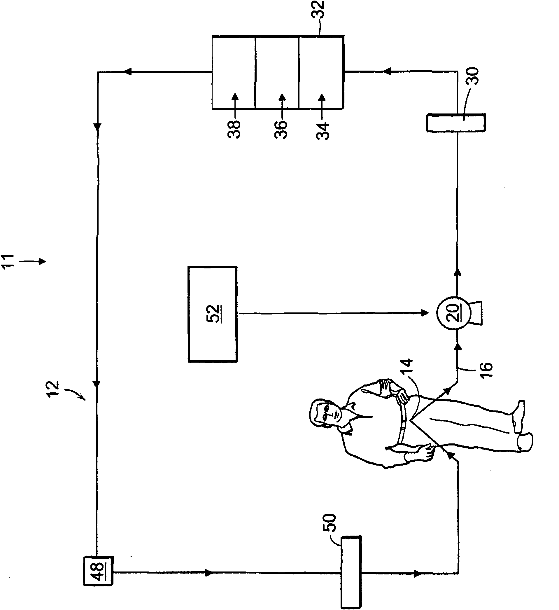 Artificial kidney dialysis system