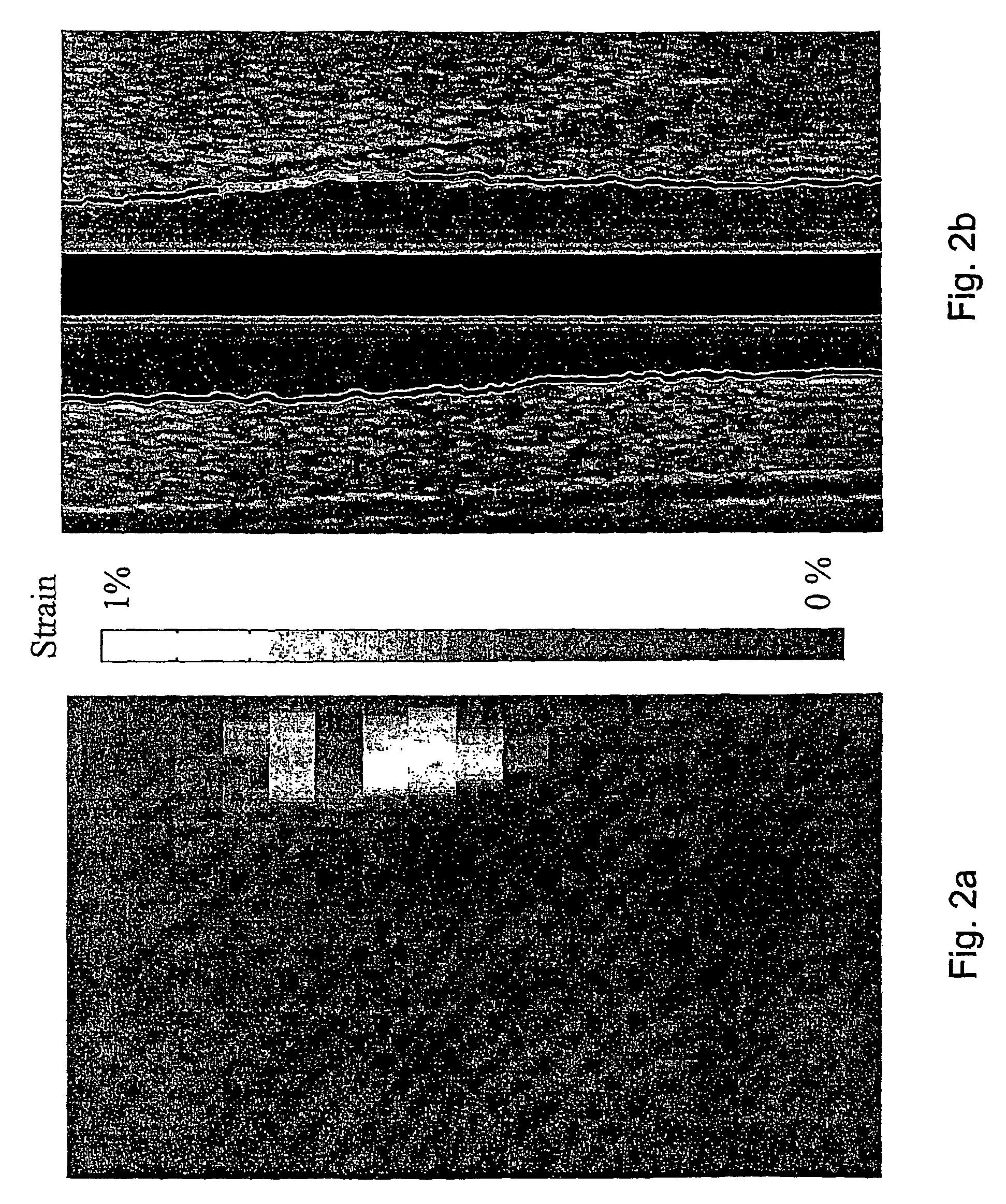 Three-dimensional tissue hardness imaging