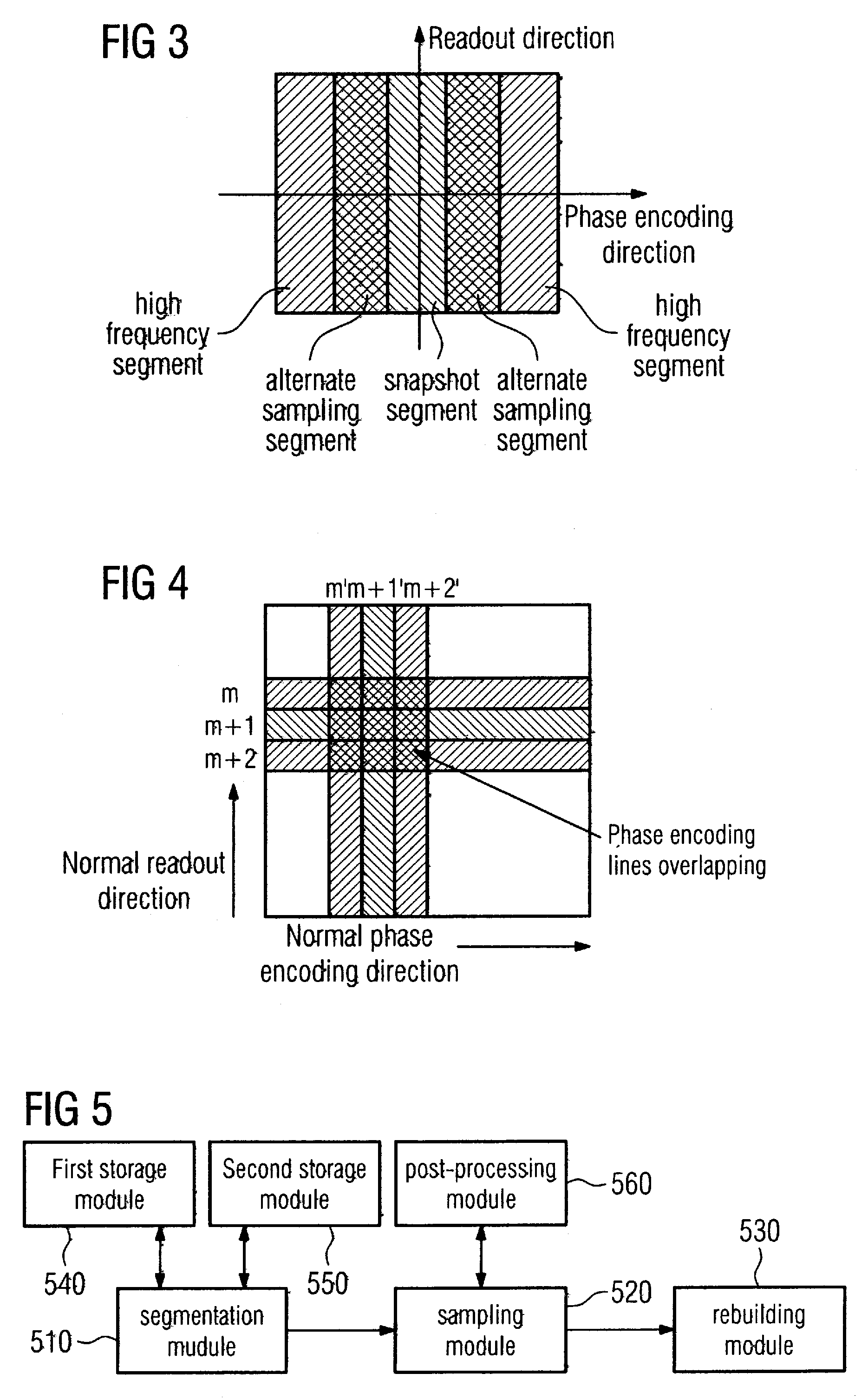 Method and device for suppressing motion artifacts in magnetic resonance imaging