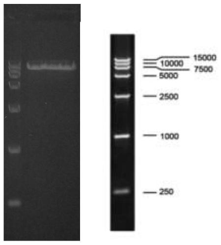 Lentivirus-infected human epidermal keratinocyte strain as well as construction method and application thereof