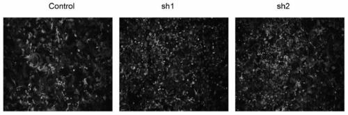 Lentivirus-infected human epidermal keratinocyte strain as well as construction method and application thereof