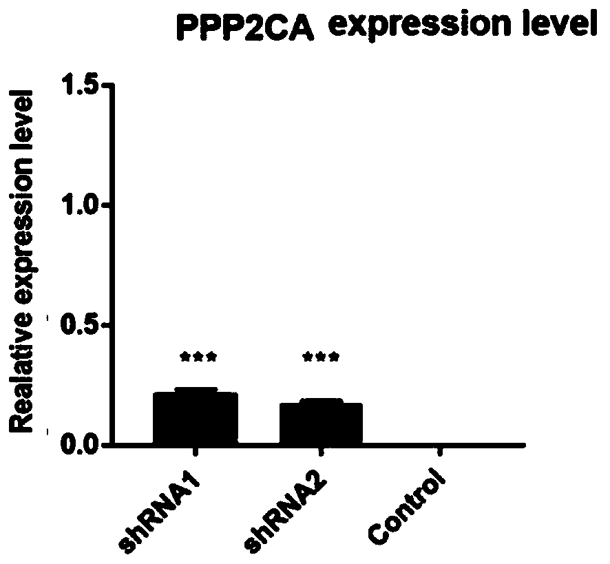 Lentivirus-infected human epidermal keratinocyte strain as well as construction method and application thereof