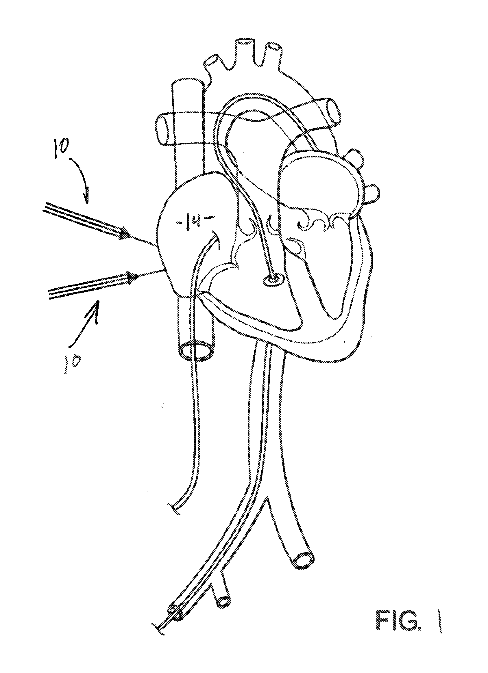 Introductory assembly and method for inserting intracardiac instruments