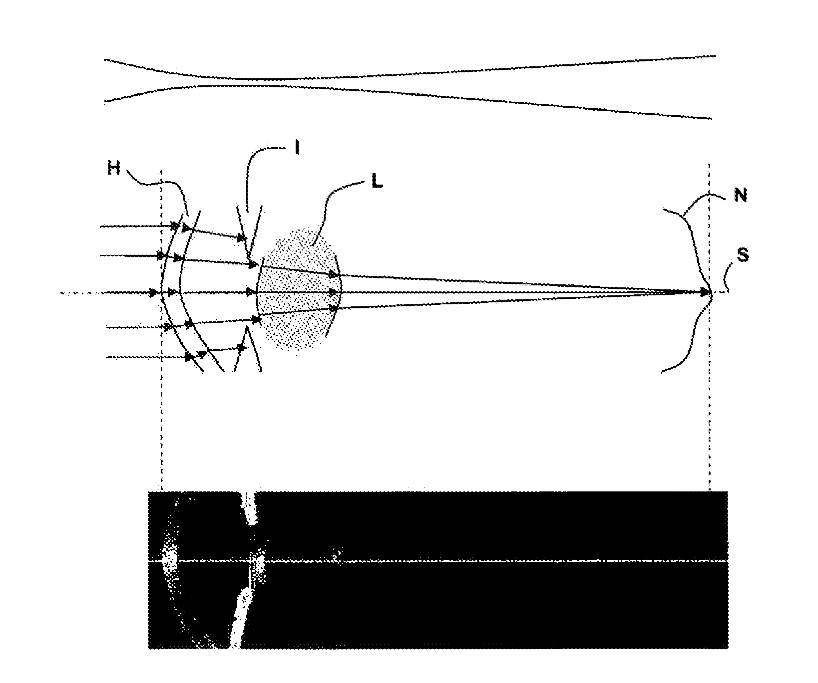 Method and device for recording and displaying an oct whole-eye scan