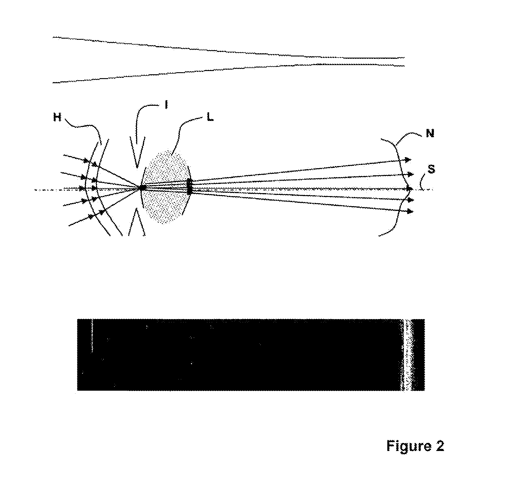Method and device for recording and displaying an oct whole-eye scan
