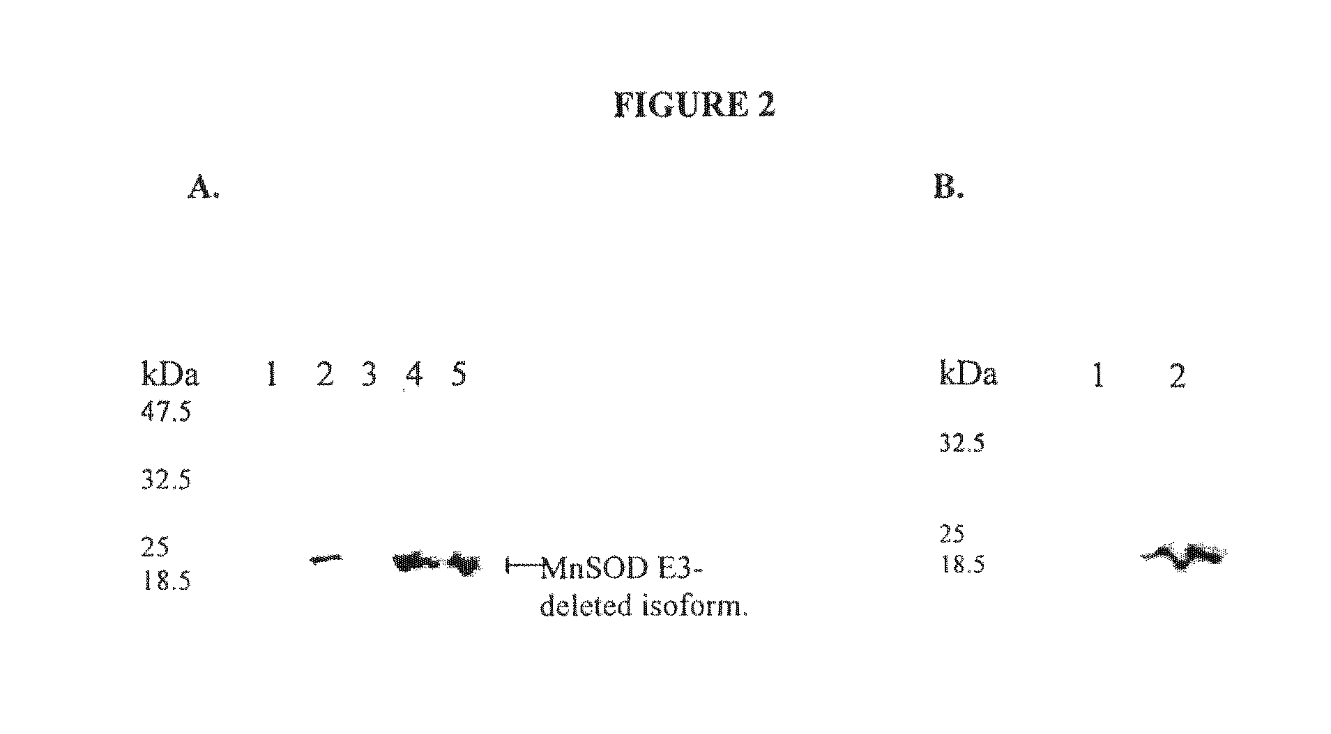 Compositions and methods for inhibiting an isoform of human manganese superoxide dismutase