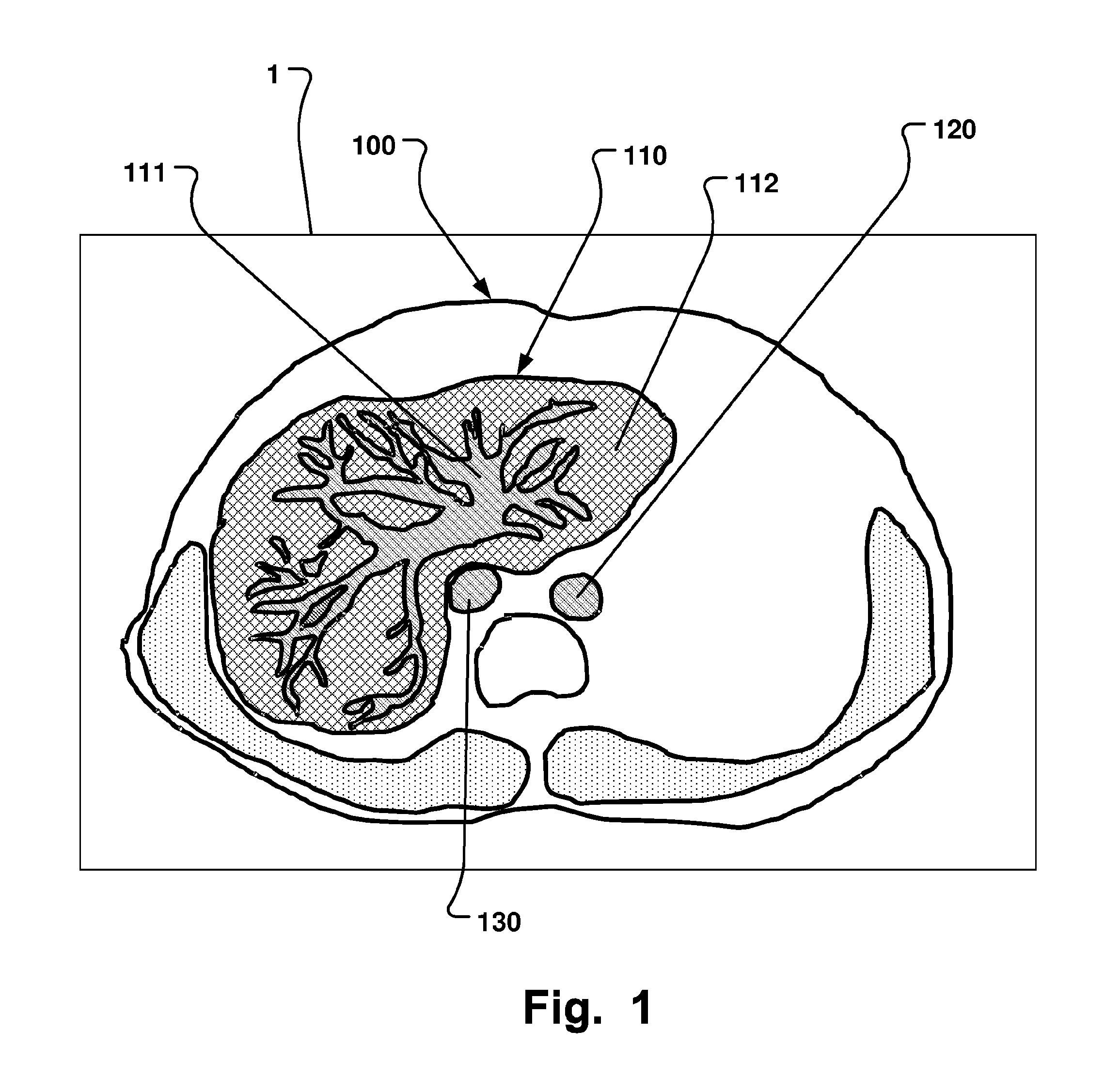 Computer-Based Method And System For Imaging-Based Dynamic Function Evaluation Of An Organ