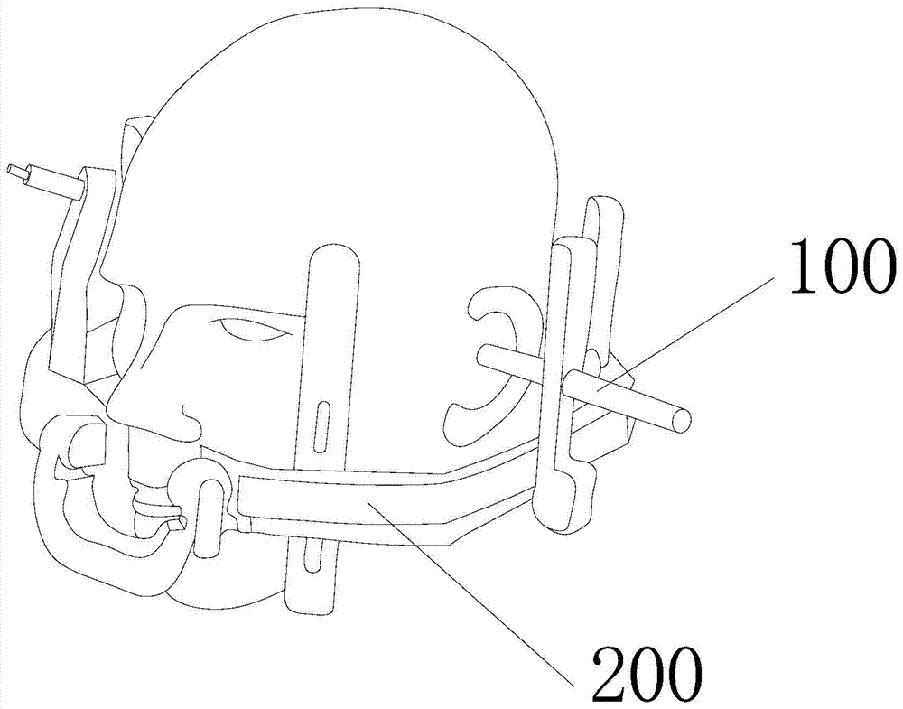 Individualized Stereotaxic Headband Placement Bracket
