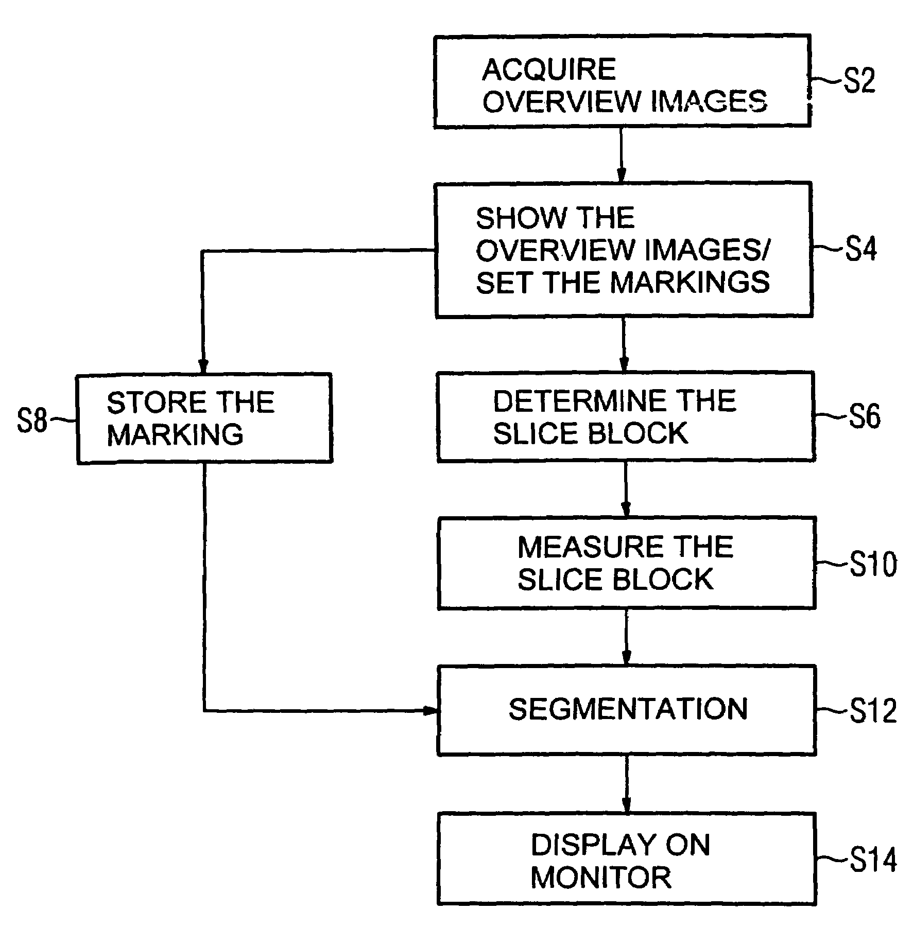 Method for segmenting a medical data set